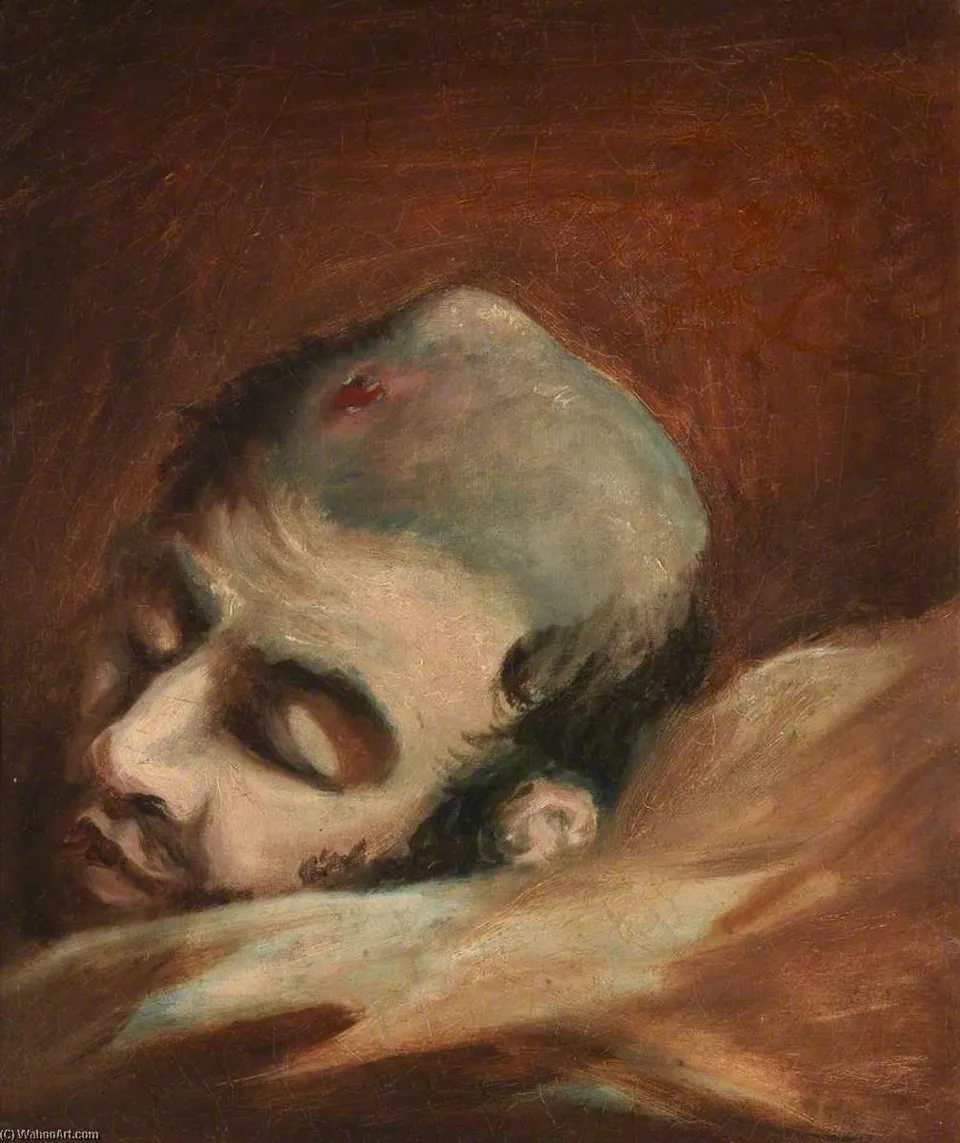 The Wounded Following The Battle Of Corunna Bullet Wound Of Skull — Чарльз Белл