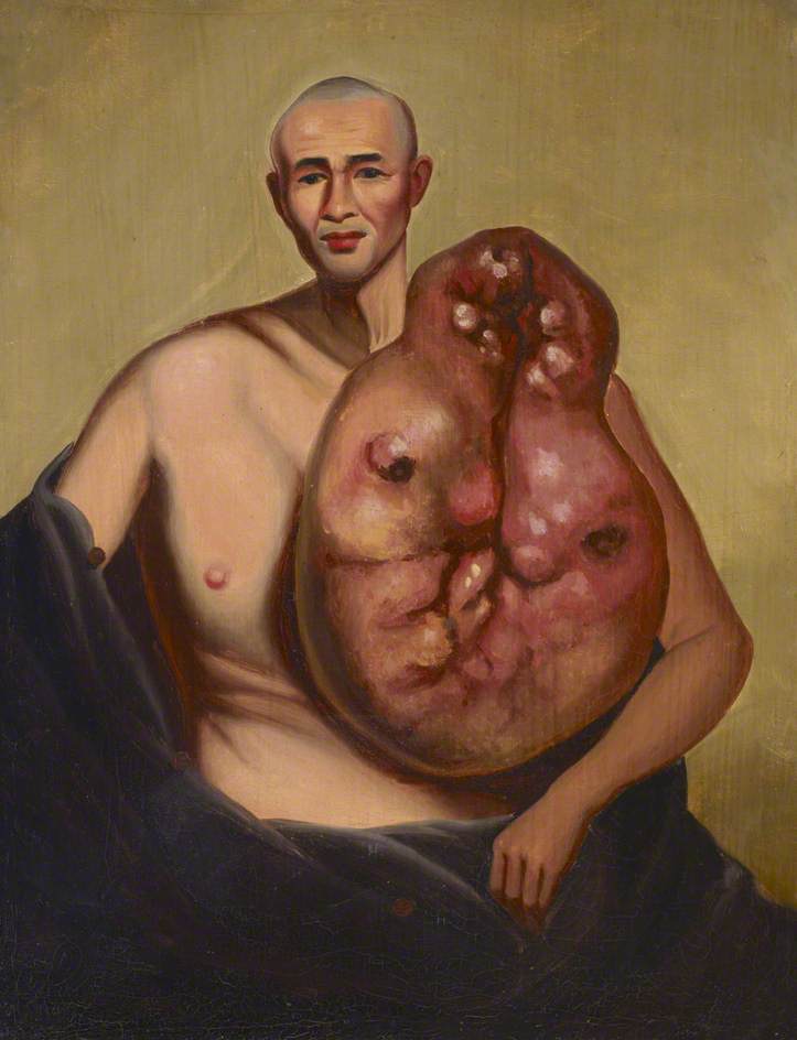 Case No.5111 — Guan Qiaochang Lamqua