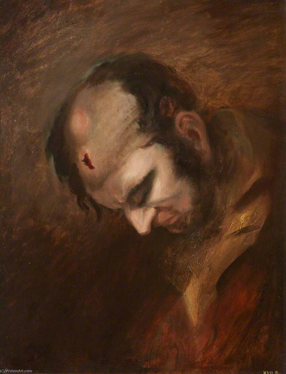 The Wounded Following The Battle Of Corunna Musket Ball Wound Of Head — Čarls Bel