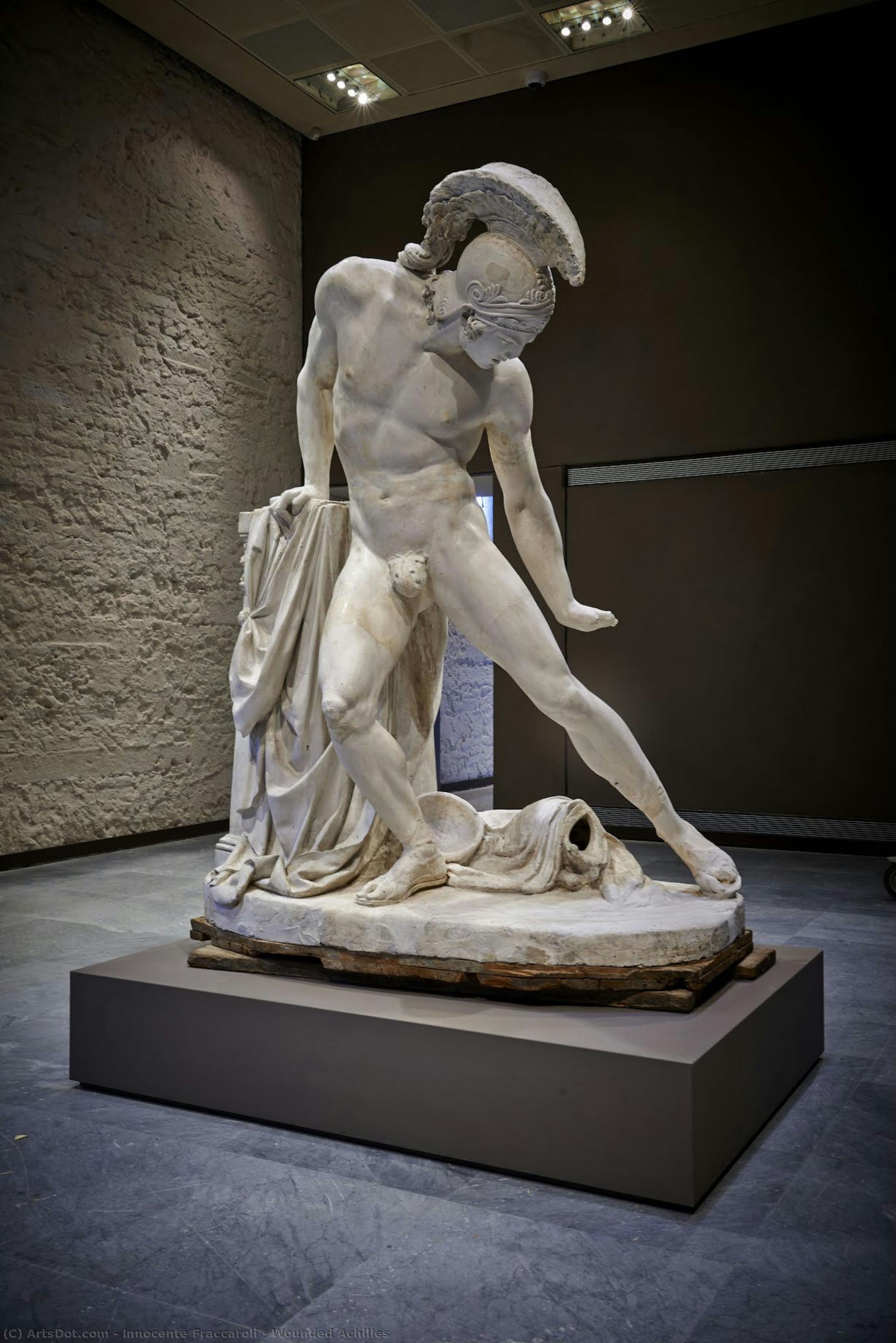 Wounded Achilles — Innocente Fraccaroli