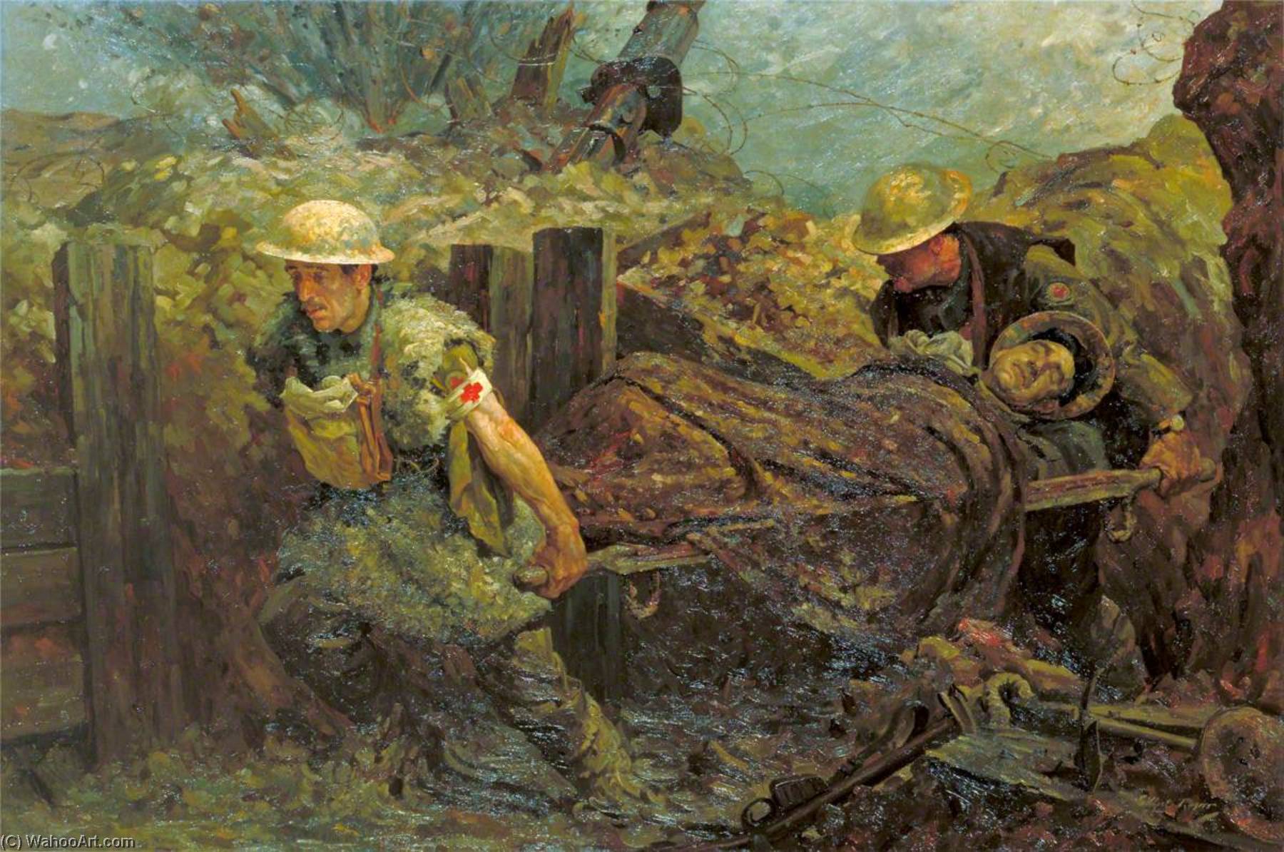 Stretcher Bearing In Difficulties — Gilbert Rogers