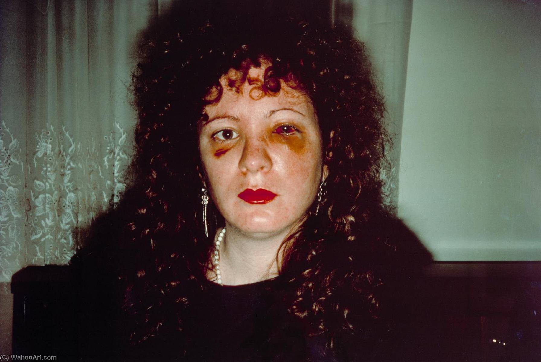 Nan One Month After Being Battered — Nan Goldin
