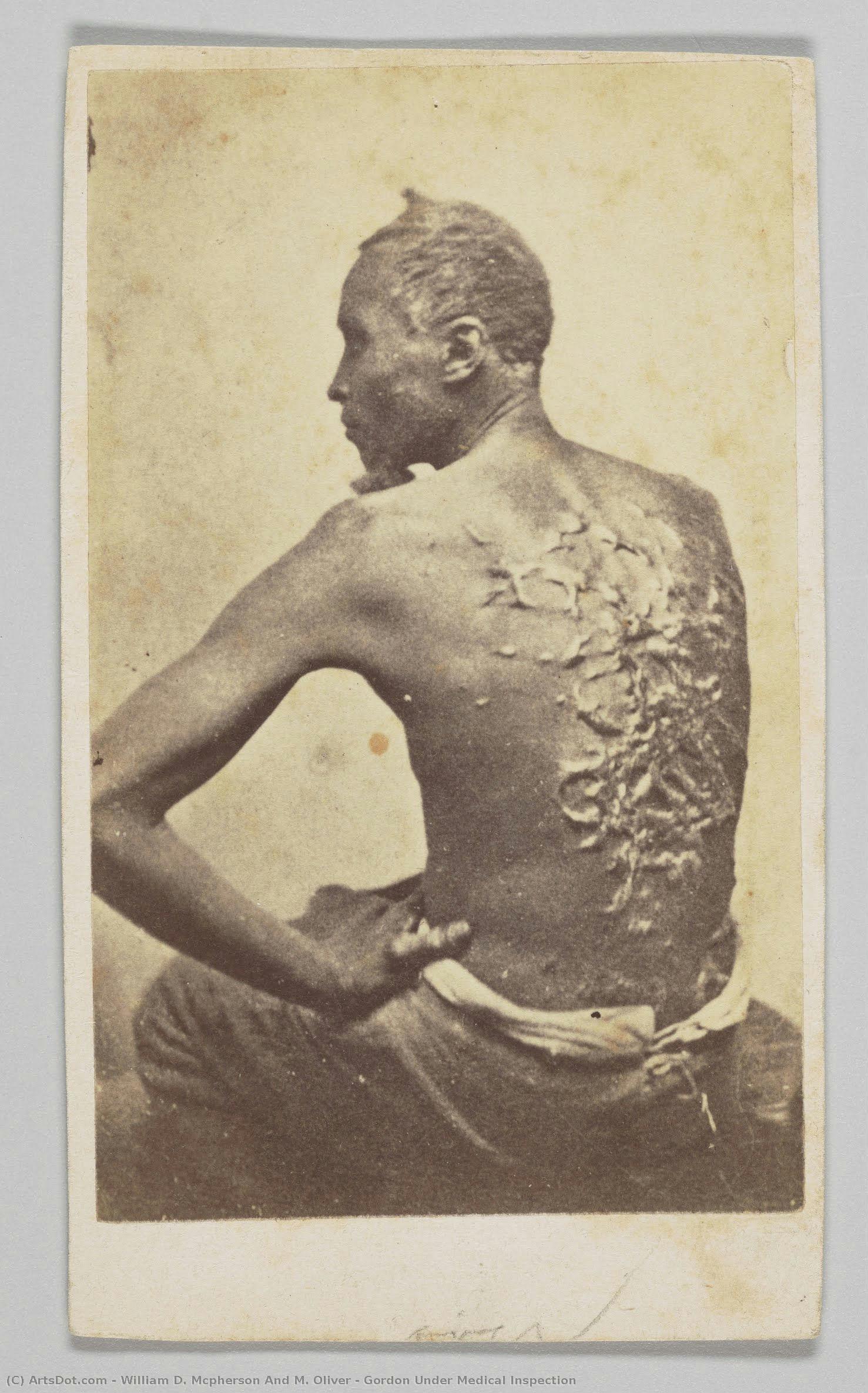 Gordon Under Medical Inspection — William D. Mcpherson And M. Oliver