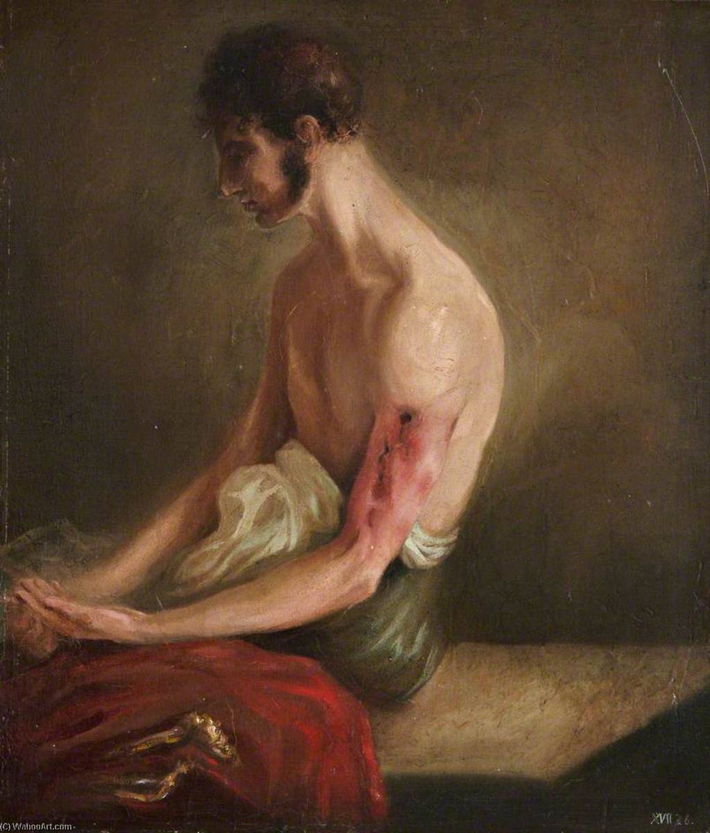 The Wounded Following The Battle Of Corunna Gunshot Fracture Of Shaft Of Humerus — Čarls Bel