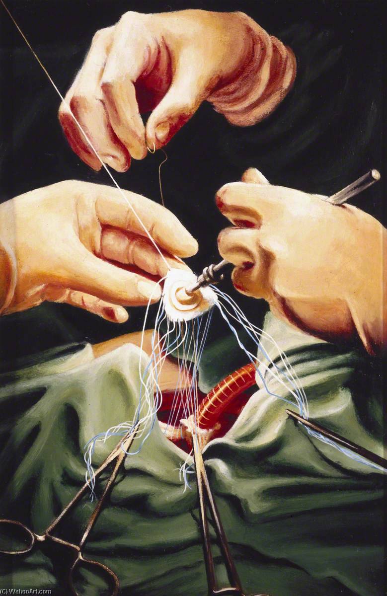 Surgeons' Hands — Keith Holmes