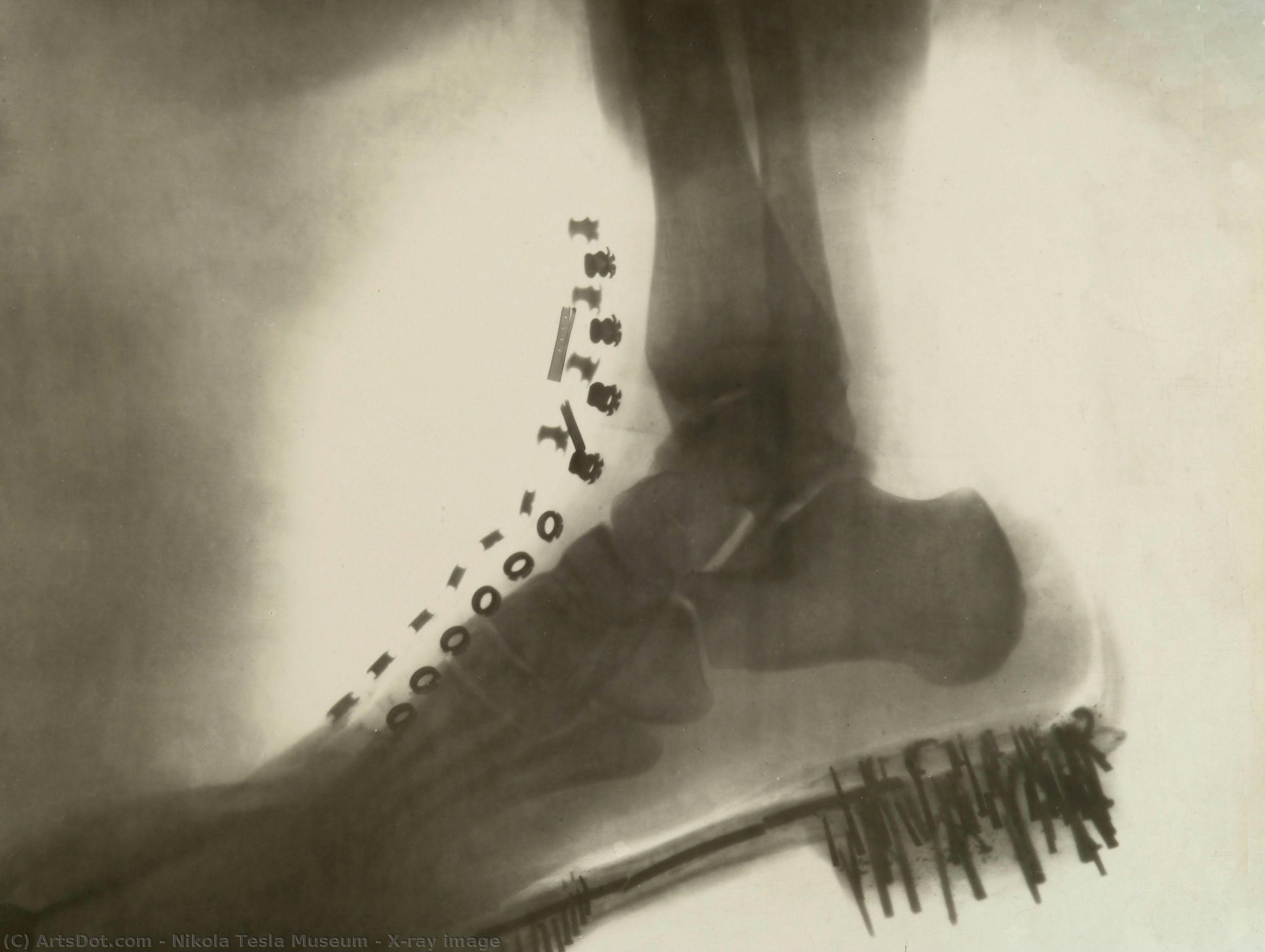 X-ray Image — Nikola Tesla Museum