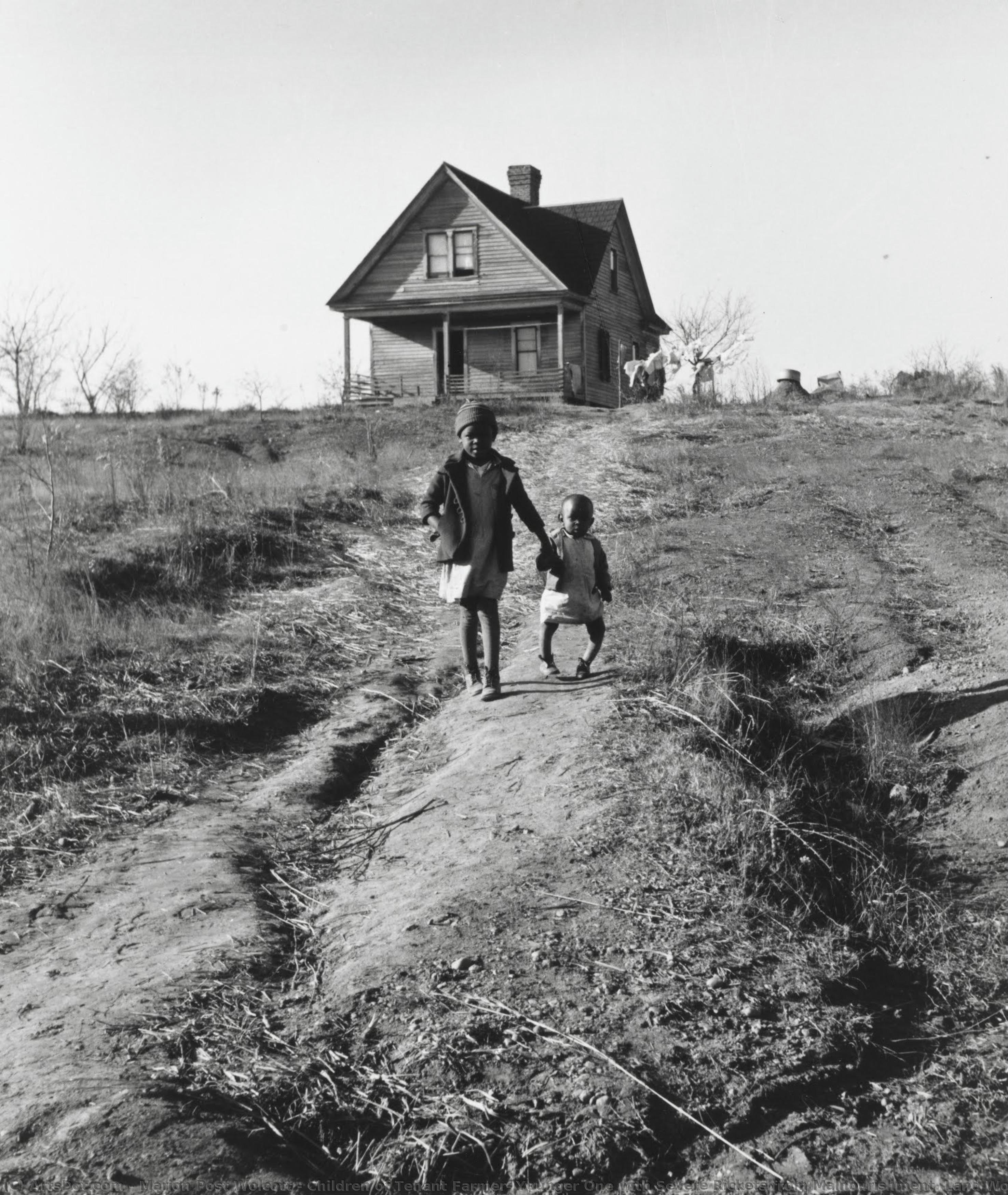 Children Of Tenant Farmer, Younger One With Severe Rickets From Malnourishment. Land Worn Out From Cotton-tobacco Culture, Near Wadesboro, North Carolina — Marion Post Wolcott