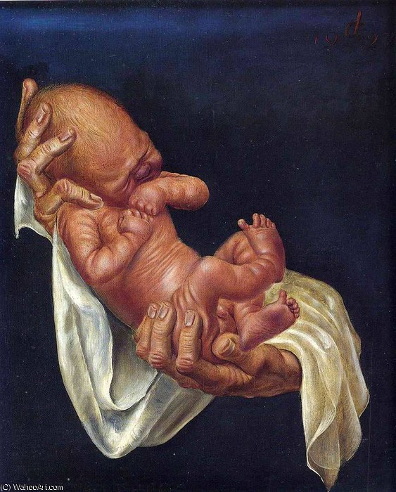 Untitled (7314) — Отто Диккс
