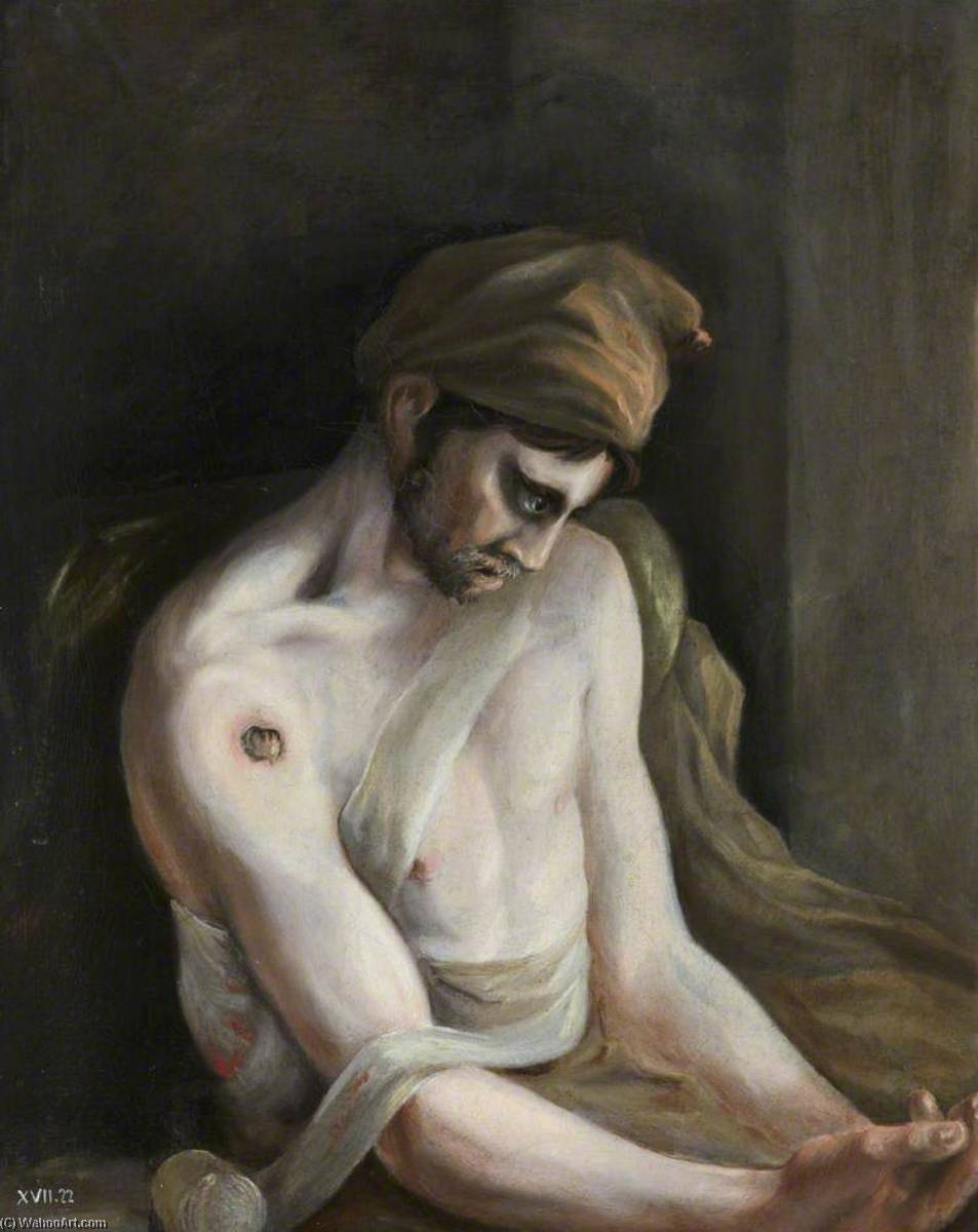 The Wounded Following The Battle Of Corunna Gunshot Wound Of Humerus — Čarls Bel