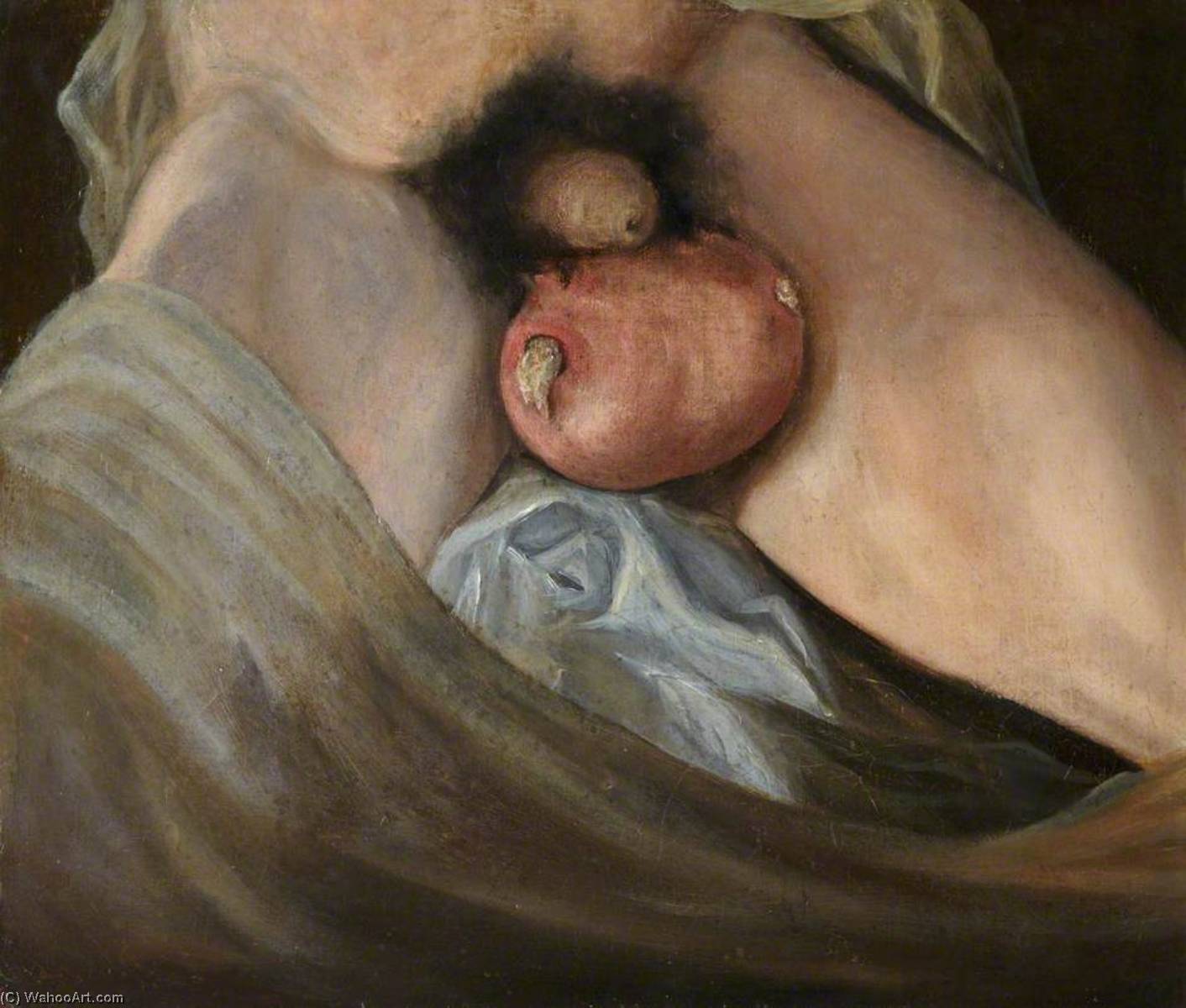 The Wounded Following The Battle Of Corunna Gunshot Wound Of Testes — Charles Bell