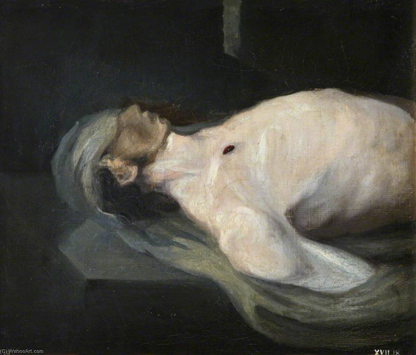 The Wounded Following The Battle Of Corunna Gunshot Wound Of Chest — Čarls Bel