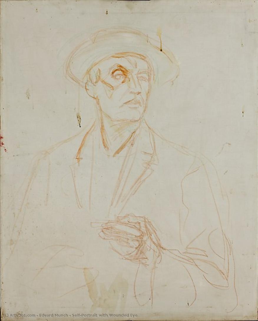 Self-portrait With Wounded Eye — Edvard Munch