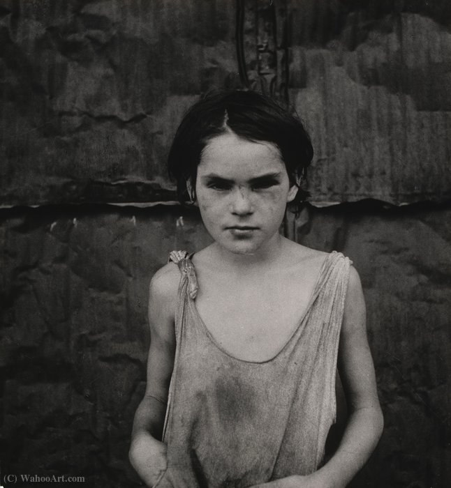 Damaged Child, Shacktown, Elm Grove, Oklahoma — Dorothea Lange