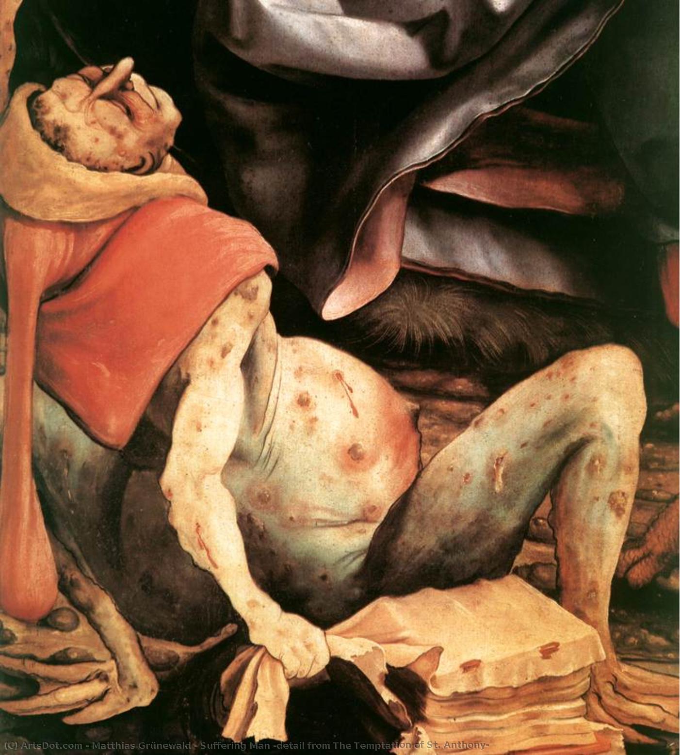 Suffering Man (detail From The Temptation Of St. Anthony) — Matthias Grünewald