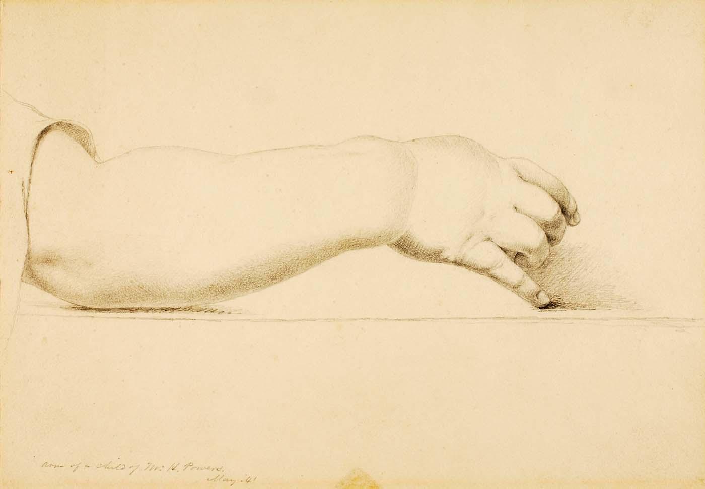 Arm Of Child Of Hiram Powers — Miner Kilbourne Kellogg