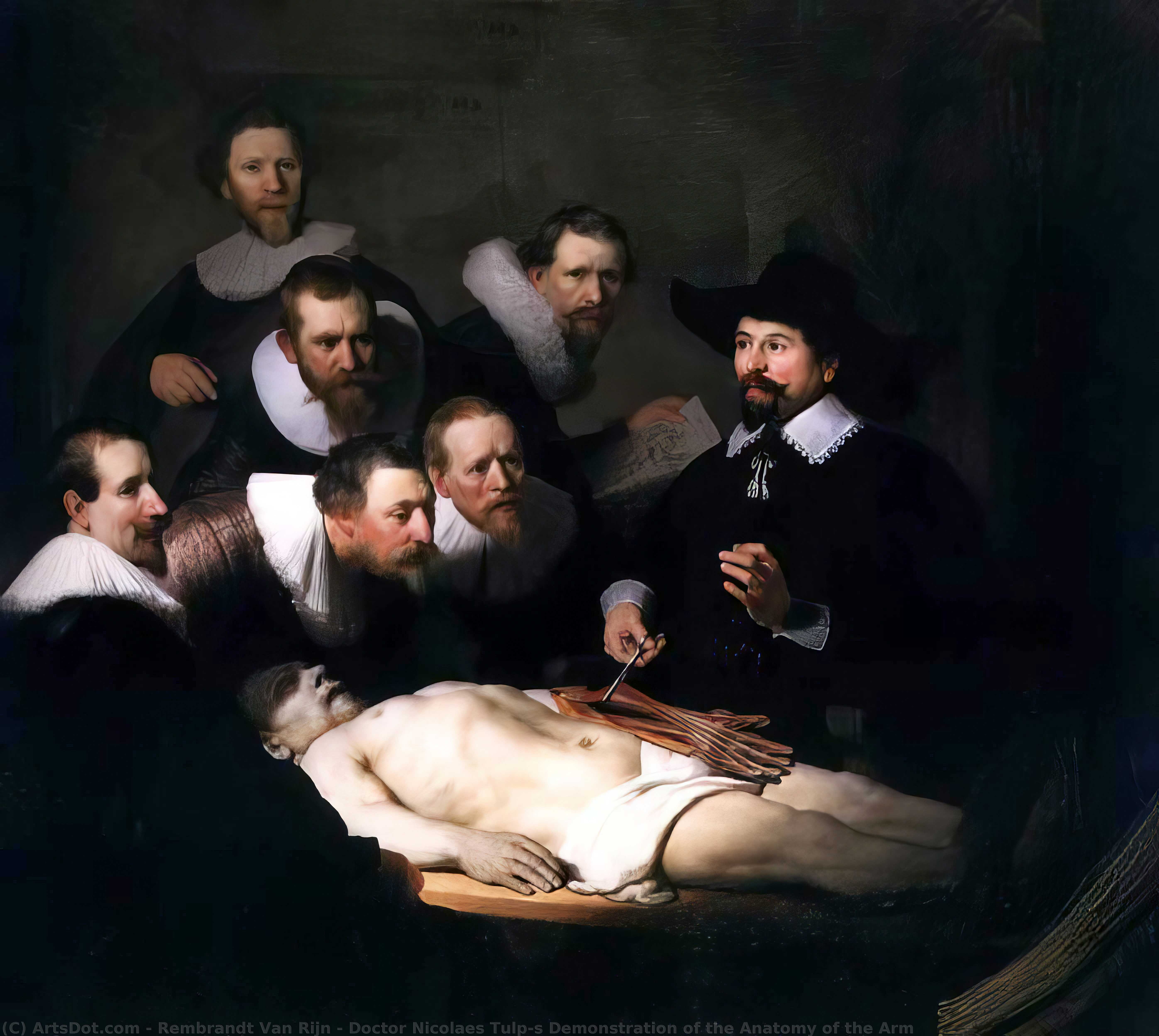 Dr. Nicolaes Tulps Demonstration Der Anatomie Des Arms — Rembrandt Van Rijn
