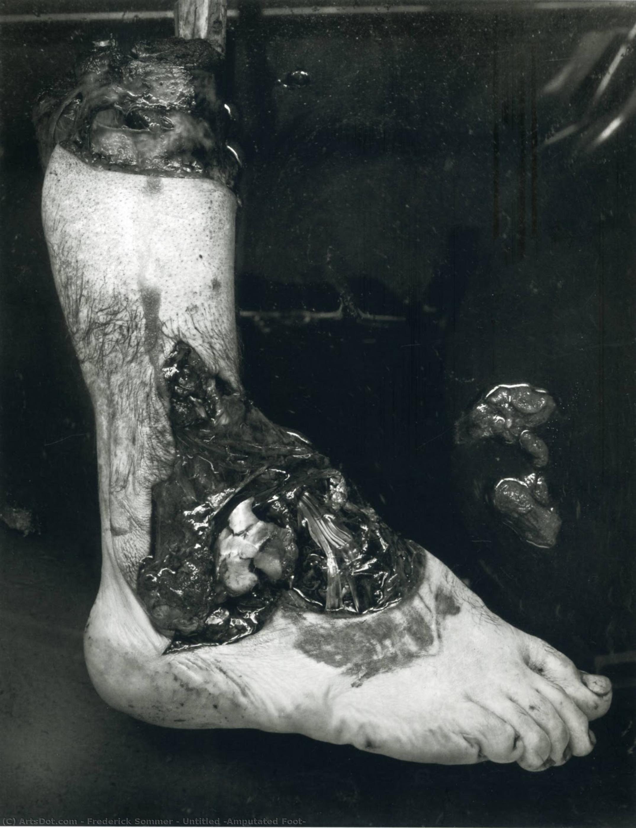 Untitled (amputated Foot) — Frederick Sommer