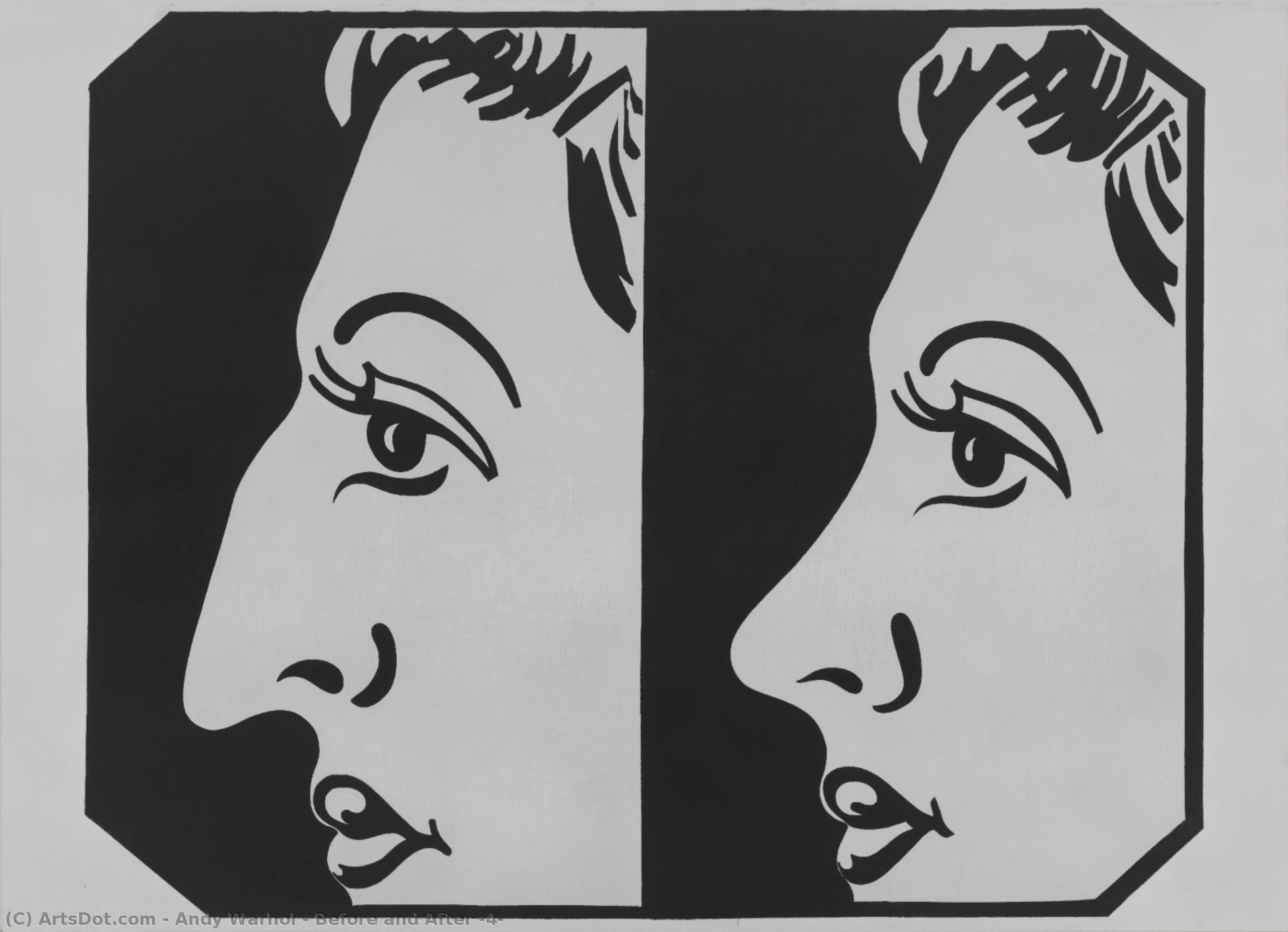 Before And After (4) — Endi Varhol