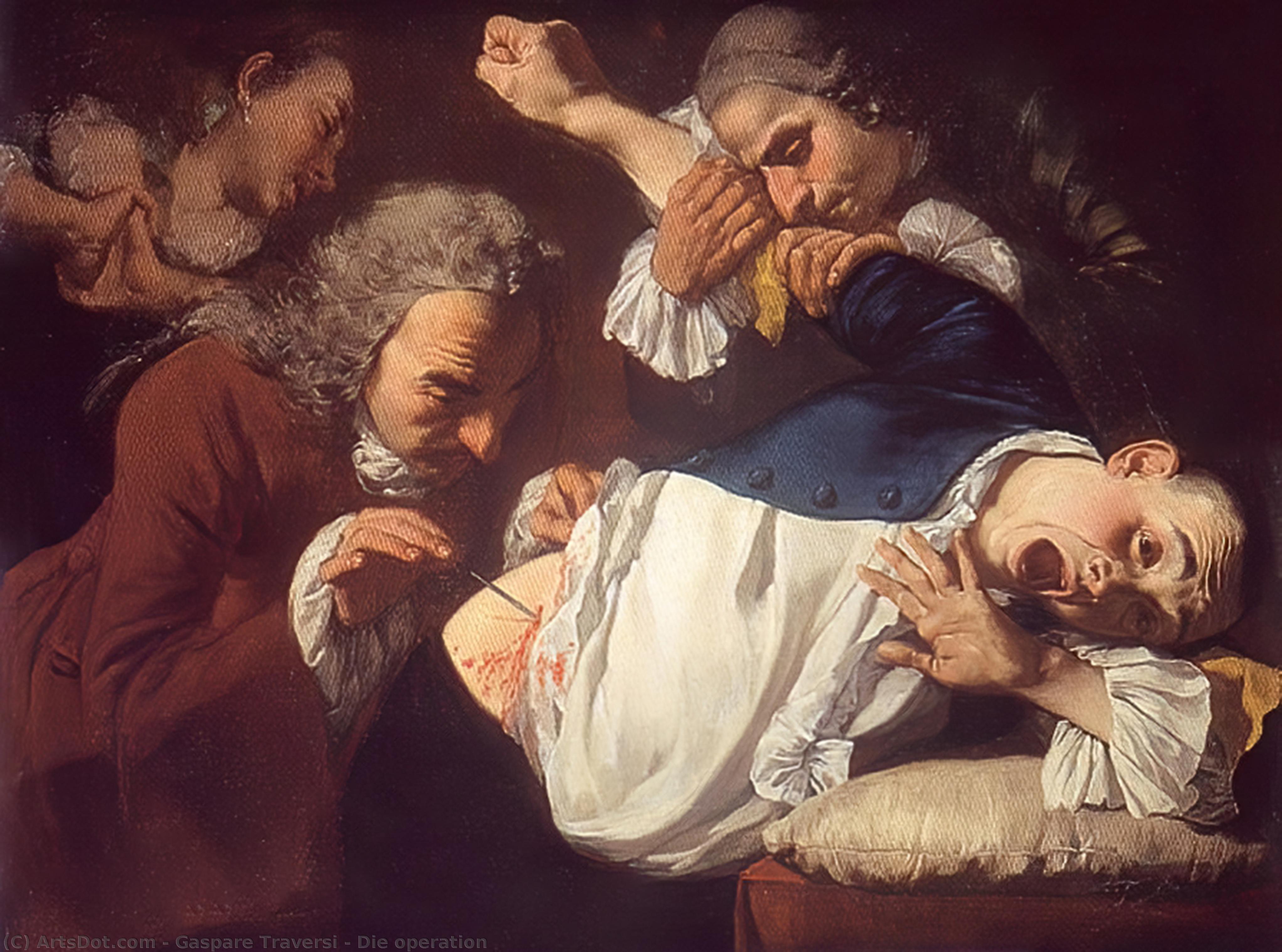 Die Operation — Gaspare Traversi