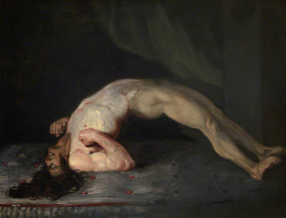 The Wounded Following The Battle Of Corunna Tetanus Following Gunshot Wounds — Charles Bell