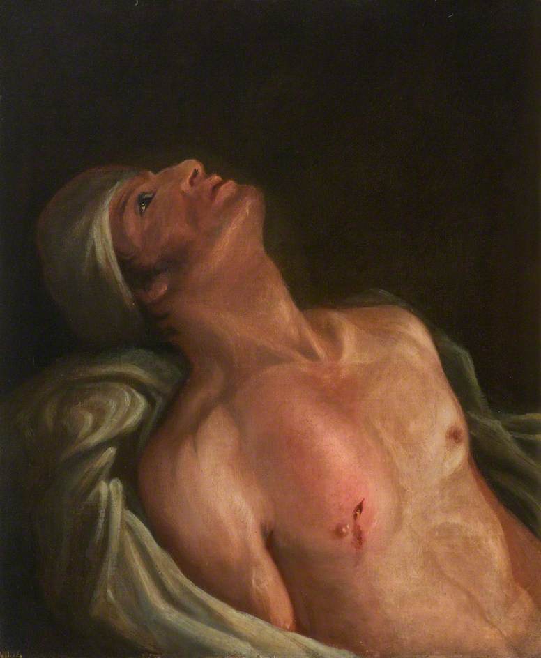 The Wounded Following The Battle Of Corunna Gunshot Wound Of Scapula — Charles Bell