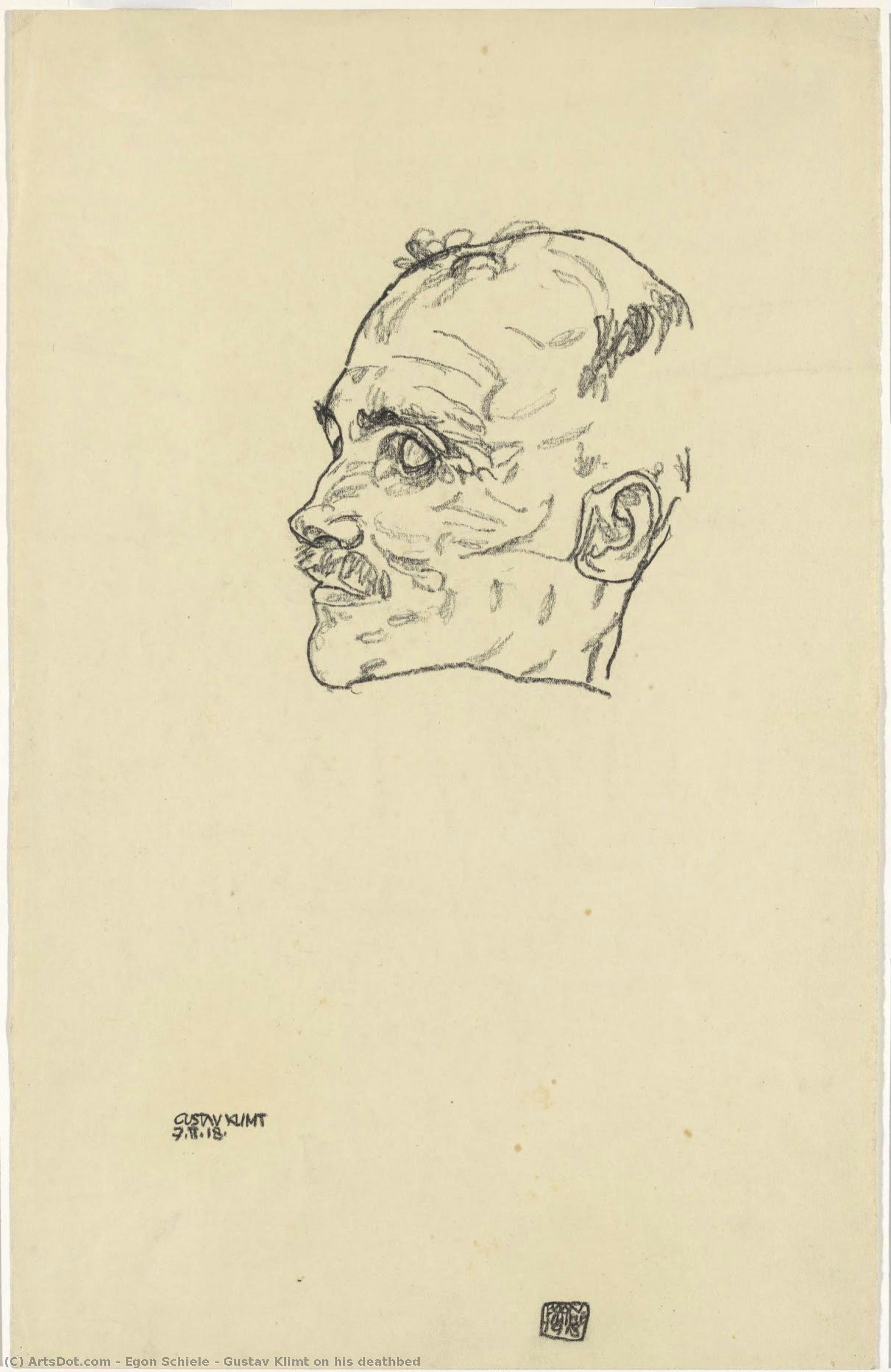 Gustav Klimt On His Deathbed — Egon Schiele
