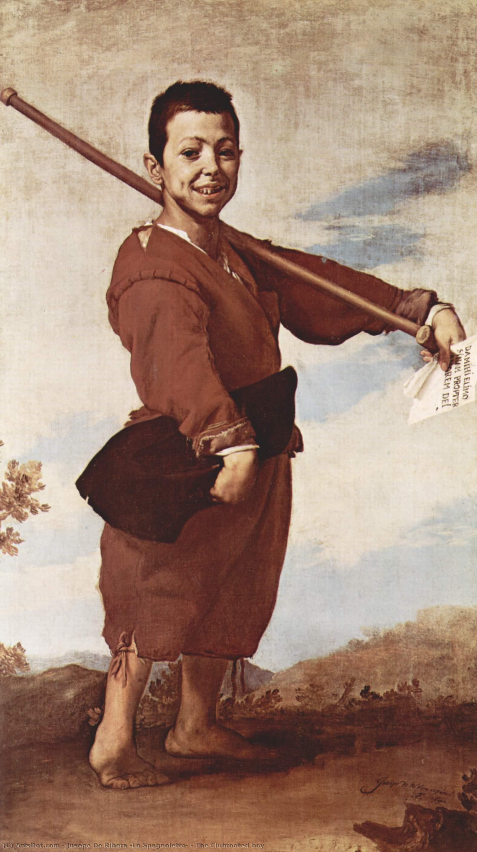 The Clubfooted Boy — Jusepe De Ribera