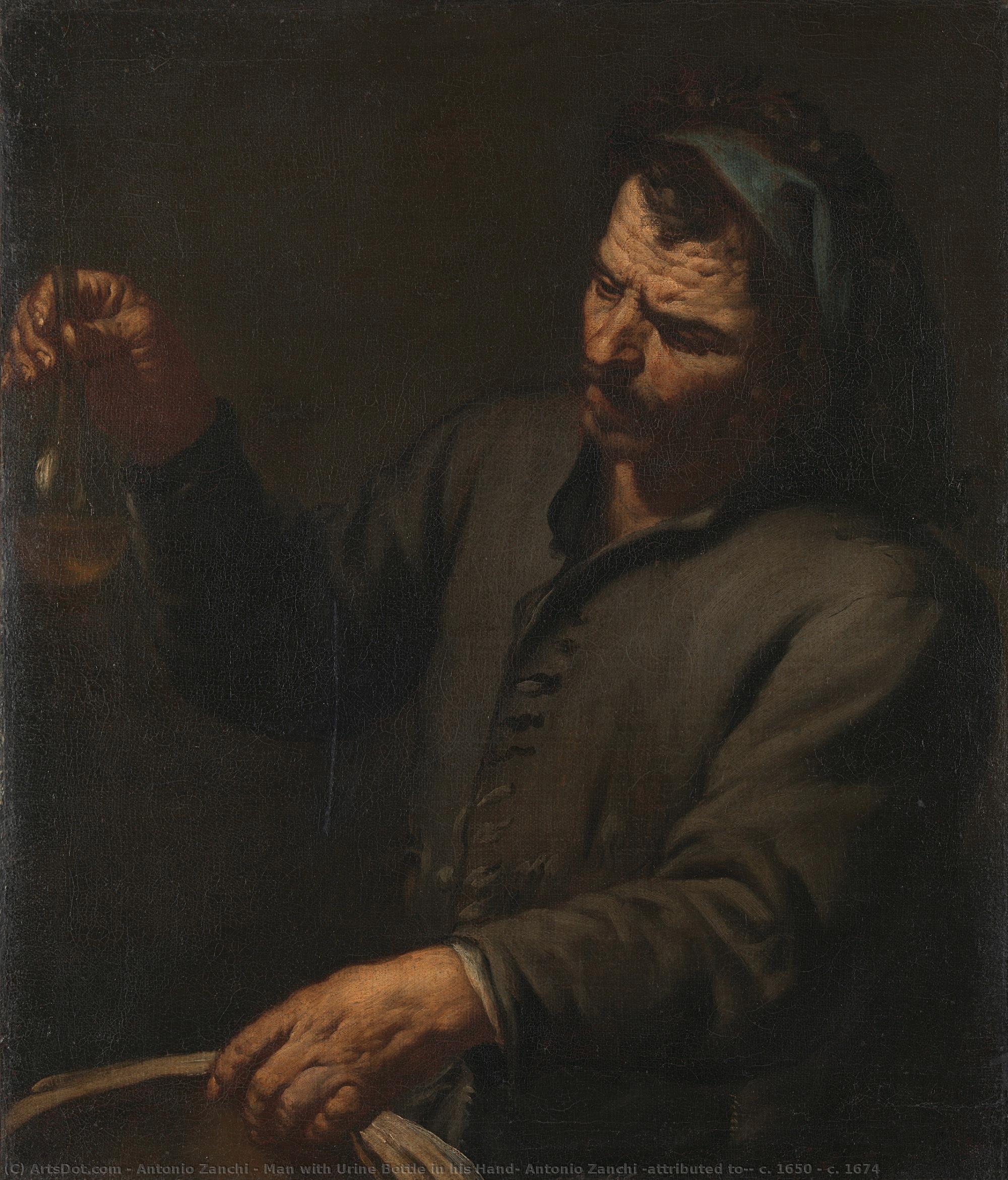 Man With Urine Bottle In His Hand, Antonio Zanchi (attributed To), C. 1650 - C. 1674 — Antonio Zanchi