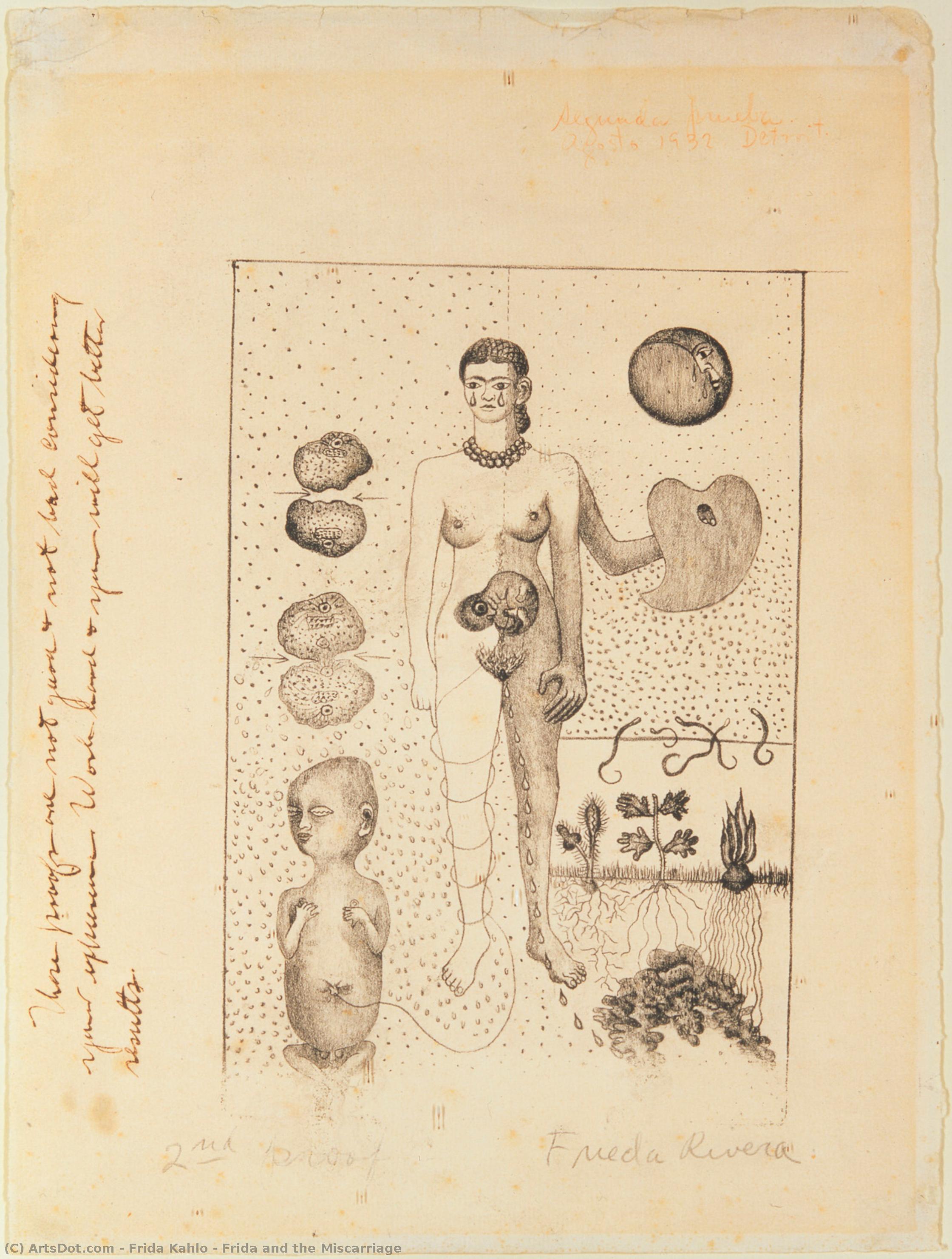 Frida And The Miscarriage — フリーダ・カーロ
