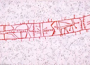 Bridge — Gene Bernard Davis