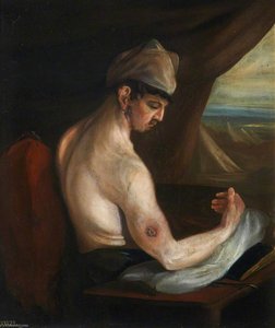 The Wounded Following The Battle Of Corunna Musket Ball Wound Of Humerus — Čarls Bel