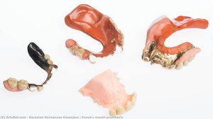 Freud’s Mundprothese — Varaztad Kazanjian