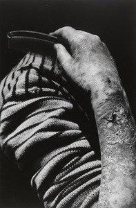 Hibakusha Fukuda Sumako, Nagasaki — Shomei Tomatsu