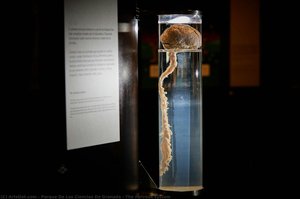 The nervous system