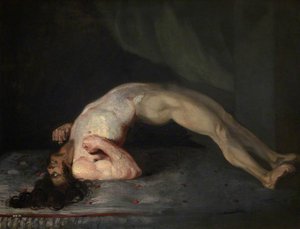 The Wounded Following The Battle Of Corunna Tetanus Following Gunshot Wounds — Čarls Bel