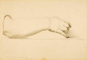 Arm Of Child Of Hiram Powers — Miner Kilbourne Kellogg
