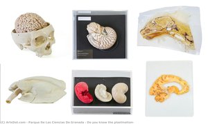 Do you know the plastination?