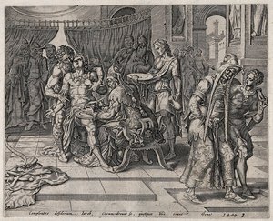 The circumcision of the Shechemites