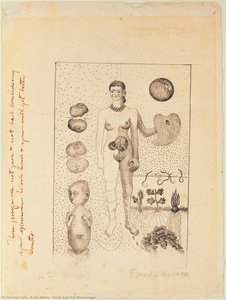 Frida Y El Aborto — Frida Kahlo, Surrealismo