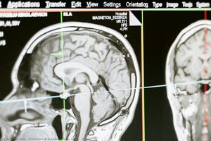 X-ray