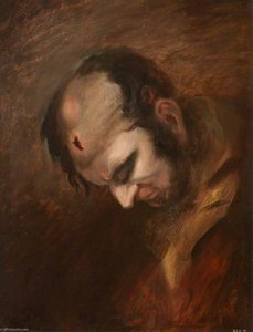 The Wounded Following The Battle Of Corunna Musket Ball Wound Of Head — Charles Bell, Romanticism