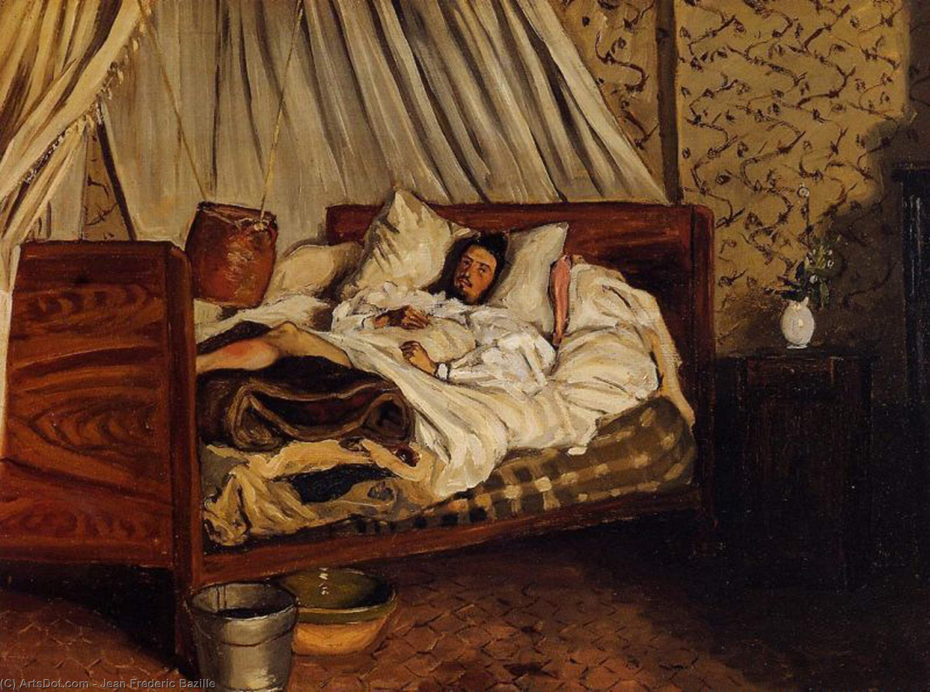 The Improvised Field Hospital (also Known As Monet After His Accident At The Inn Of Chailly) — Frédéric Bazille