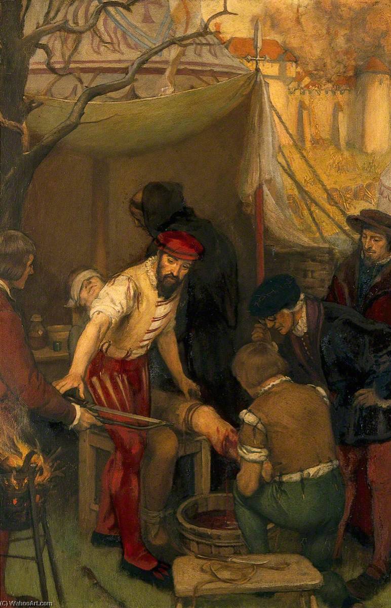 Ambroise Paré Using The Ligature When Amputating On The Battlefield At The Siege Of Bramvilliers, 1552 — Ernest Board