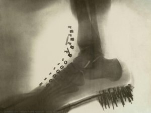 X-ray Image — Nikola Tesla Museum