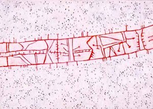 Bridge — Gene Davis