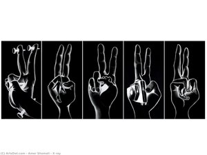 X Ray — Amer Shomali