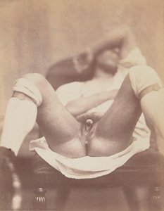 Hermaphrodite — Félix Nadar