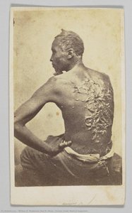 Gordon Under Medical Inspection — William D. Mcpherson And M. Oliver