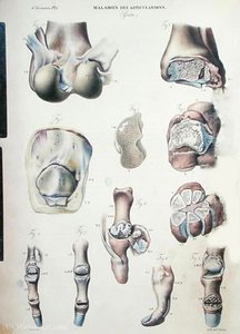 Pathological human body